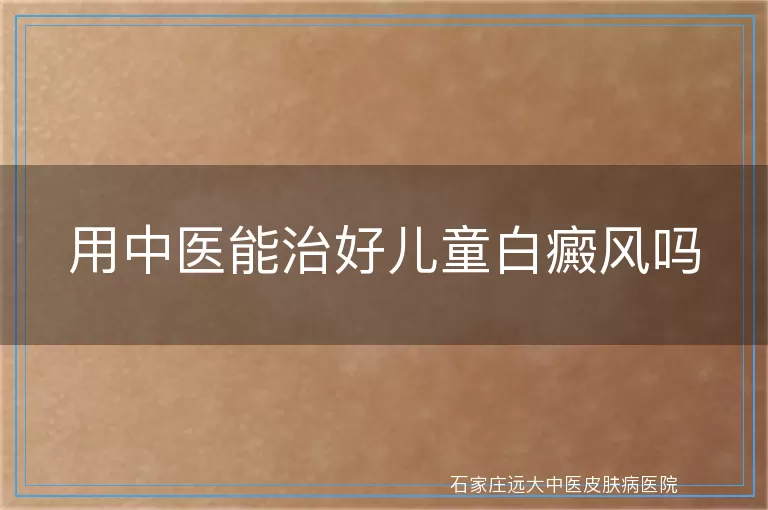 用中医能治好儿童白癜风吗