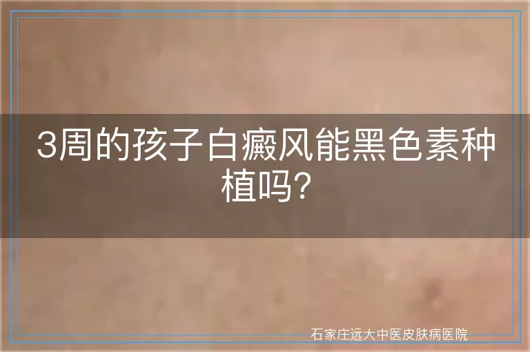 3周的孩子白癜风能黑色素种植吗？