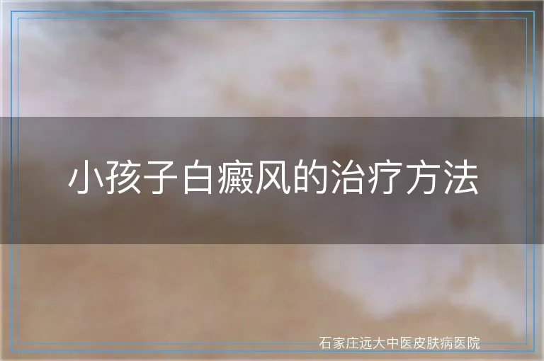 小孩子白癜风的治疗方法