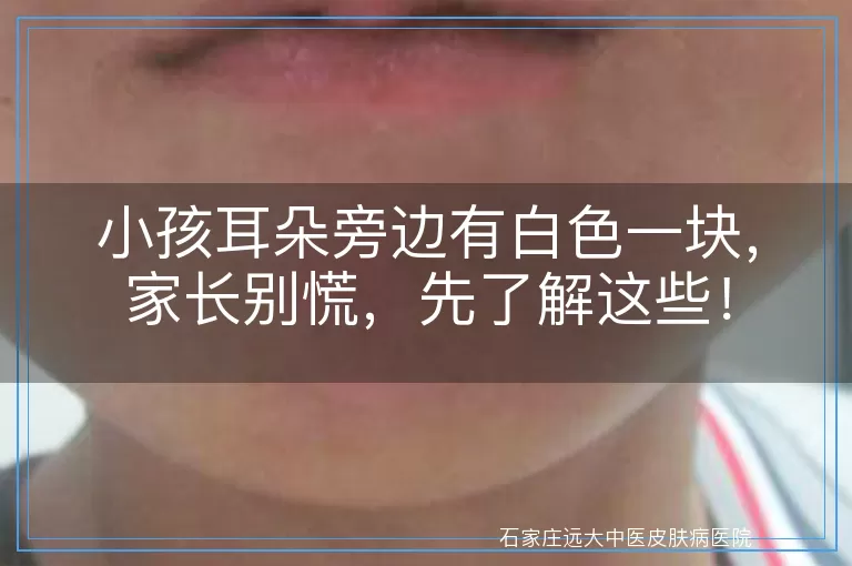 小孩耳朵旁边有白色一块，家长别慌，先了解这些！