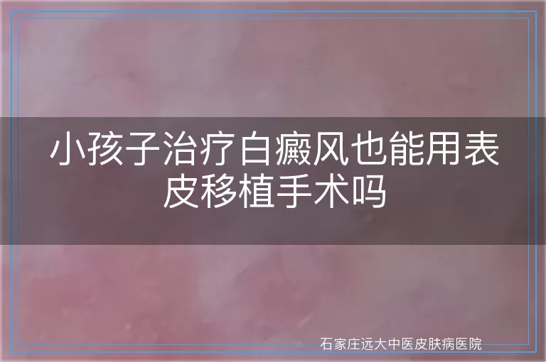 小孩子治疗白癜风也能用表皮移植手术吗