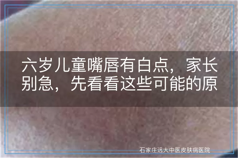 六岁儿童嘴唇有白点，家长别急，先看看这些可能的原因