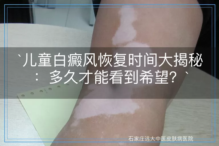 儿童白癜风恢复时间大揭秘：多久才能看到希望？