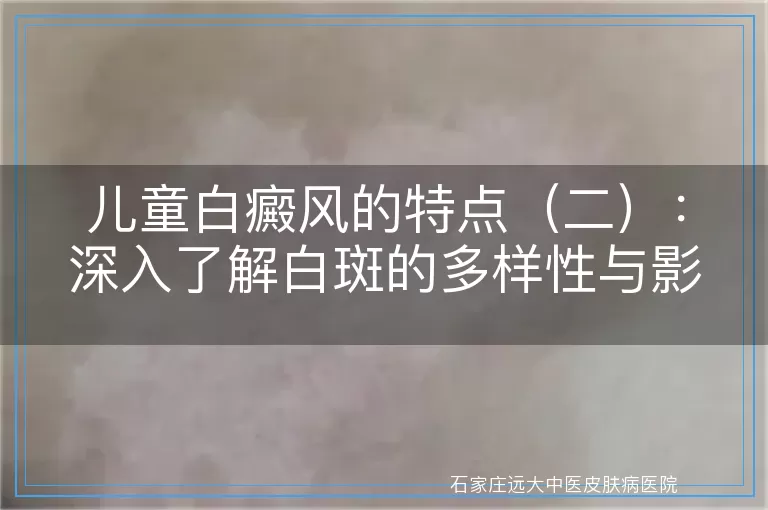 儿童白癜风的特点（二）：深入了解白斑的多样性与影响