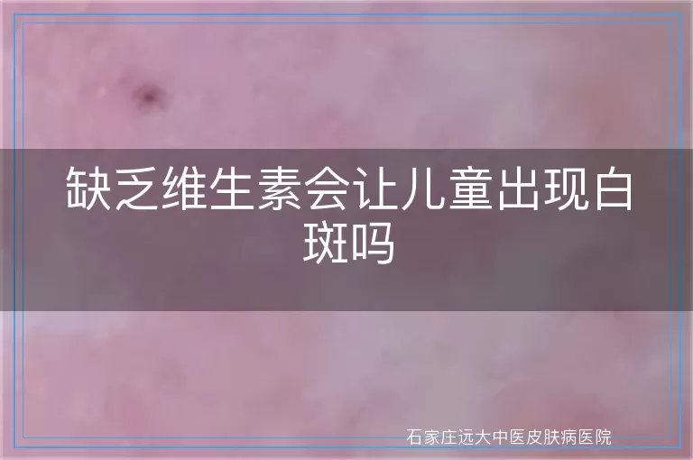 缺乏维生素会让儿童出现白斑吗