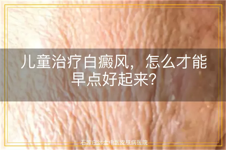 儿童治疗白癜风，怎么才能早点好起来？