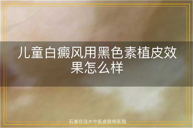 儿童白癜风用黑色素植皮效果怎么样
