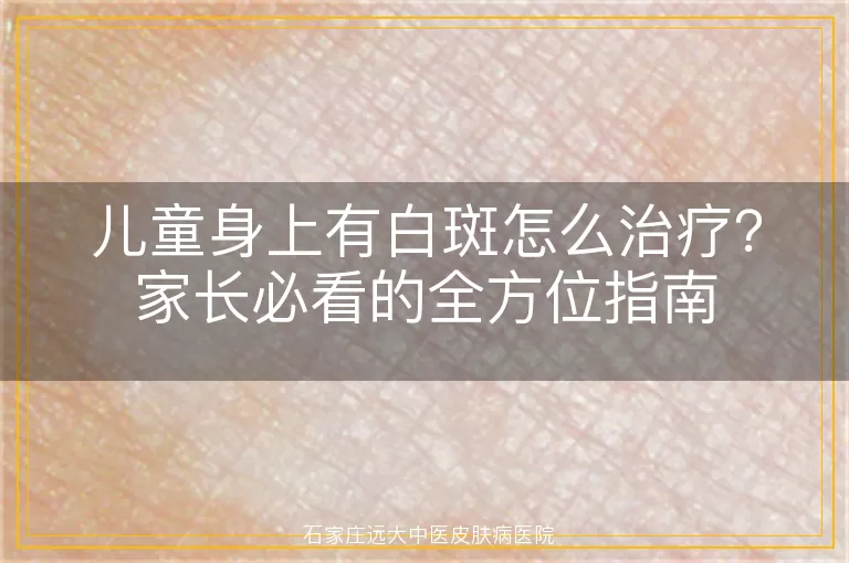 儿童身上有白斑怎么治疗？家长必看的全方位指南