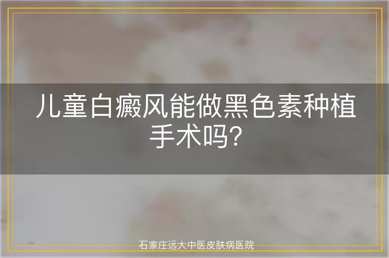 儿童白癜风能做黑色素种植手术吗？