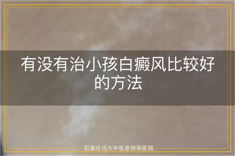 有没有治小孩白癜风比较好的方法
