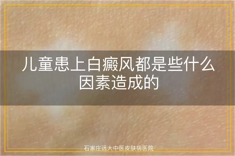 儿童患上白癜风都是些什么因素造成的