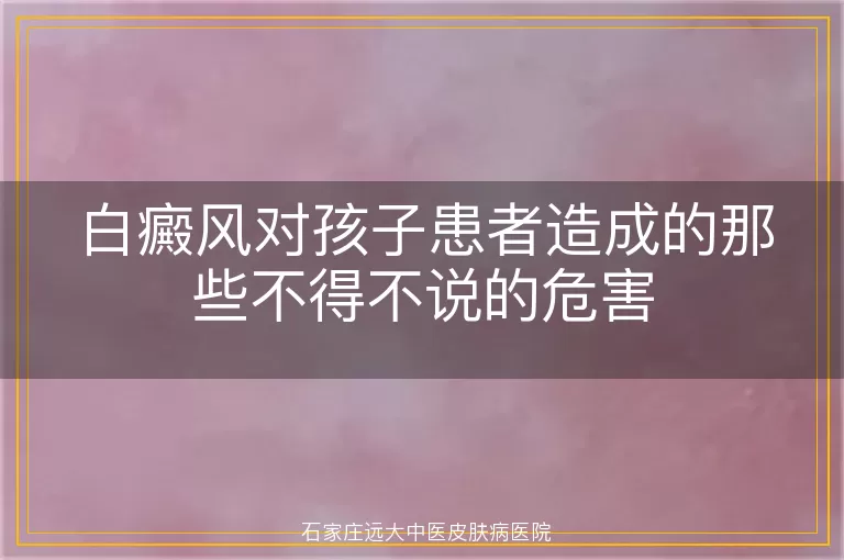 白癜风对孩子患者造成的那些不得不说的危害