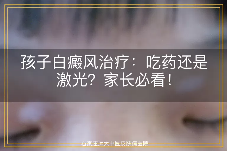 孩子白癜风治疗：吃药还是激光？家长必看！