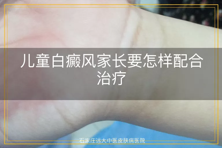 儿童白癜风家长要怎样配合治疗