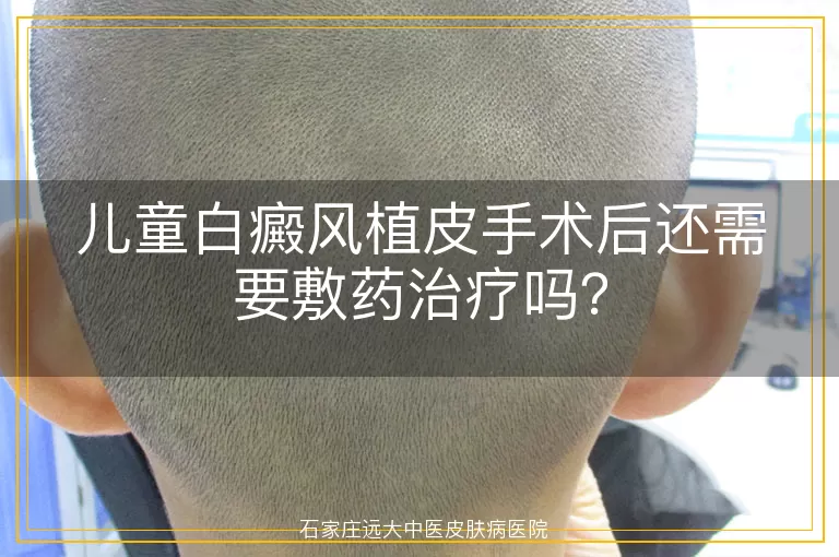 儿童白癜风植皮手术后还需要敷药治疗吗？
