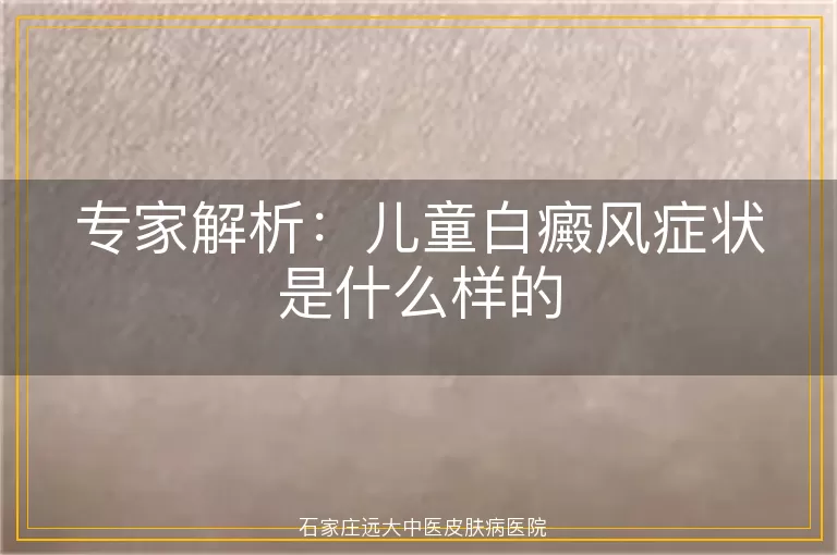 专家解析：儿童白癜风症状是什么样的