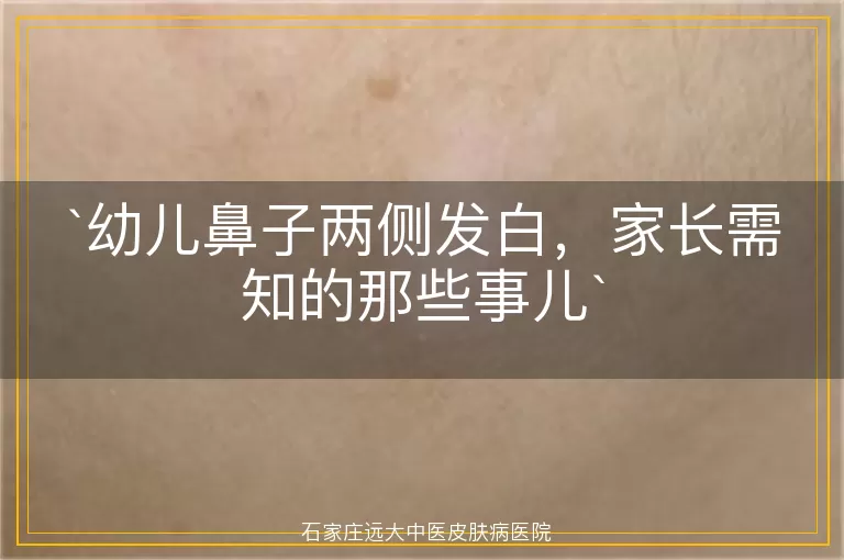 幼儿鼻子两侧发白，家长需知的那些事儿