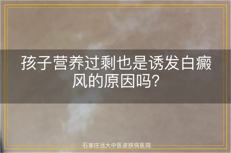 孩子营养过剩也是诱发白癜风的原因吗？
