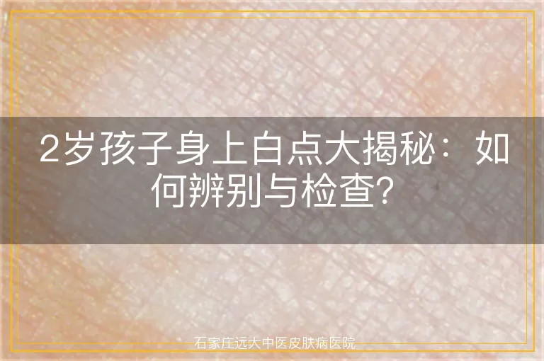 2岁孩子身上白点大揭秘:如何辨别与检查?