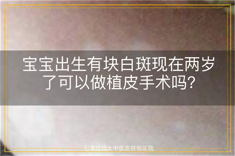 宝宝出生有块白斑现在两岁了可以做植皮手术吗？