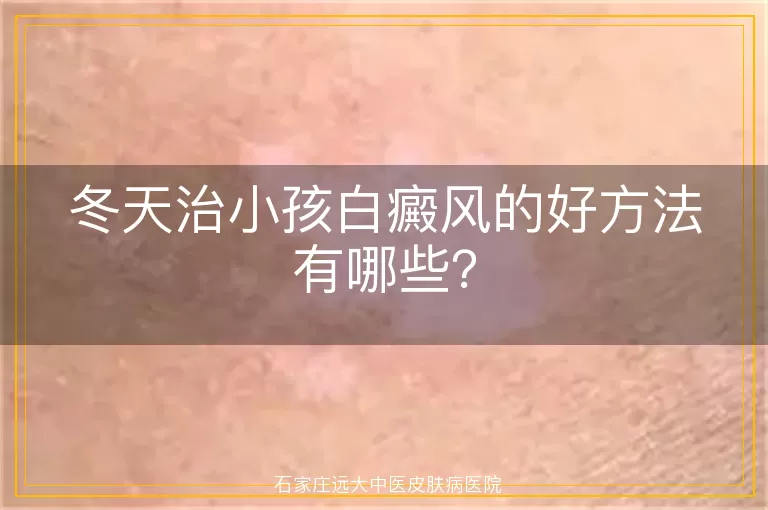 冬天治小孩白癜风的好方法有哪些？