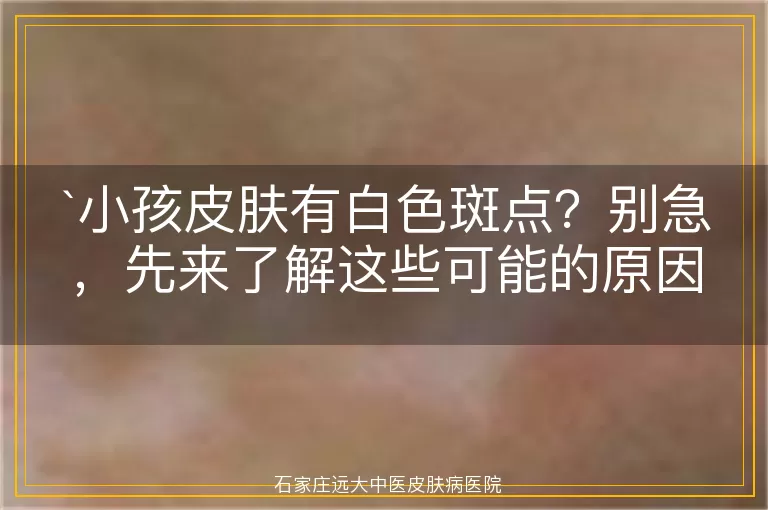 小孩皮肤有白色斑点？别急，先来了解这些可能的原因