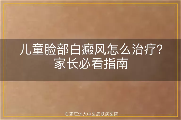 儿童脸部白癜风怎么治疗?家长必看指南