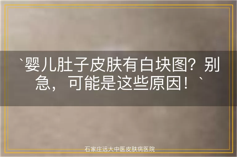 婴儿肚子皮肤有白块图？别急，可能是这些原因！