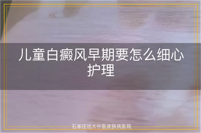 儿童白癜风早期要怎么细心护理