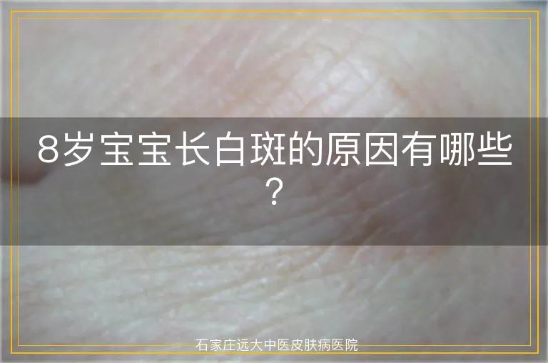 8岁宝宝长白斑的原因有哪些？