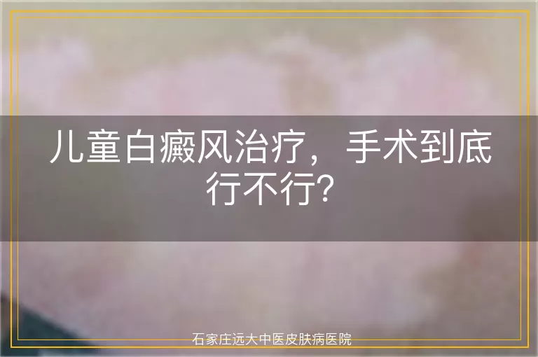 儿童白癜风治疗，手术到底行不行？