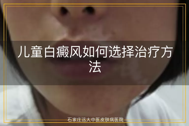 儿童白癜风如何选择治疗方法