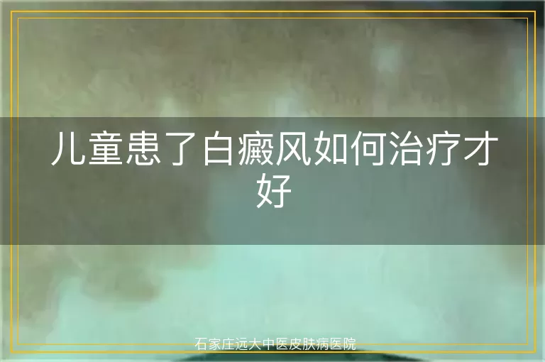 儿童患了白癜风如何治疗才好