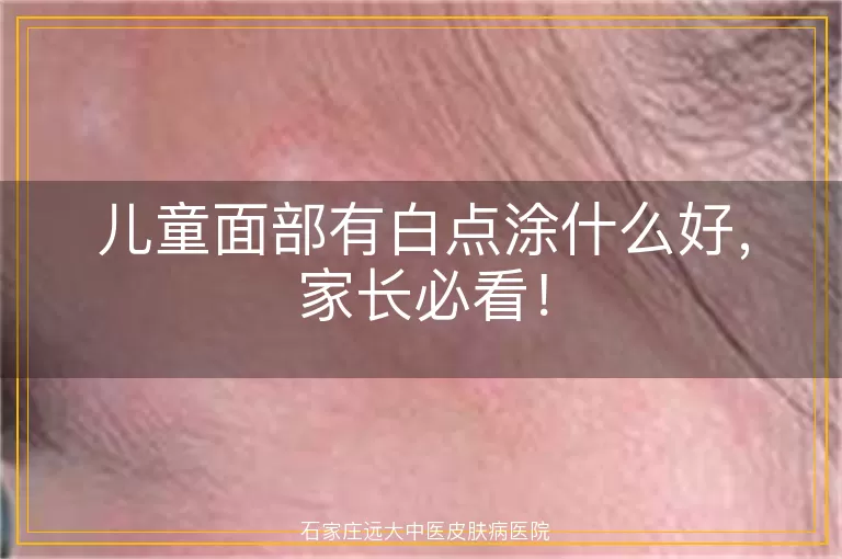 儿童面部有白点涂什么好，家长必看！
