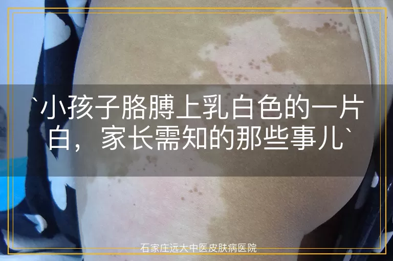 小孩子胳膊上乳白色的一片白，家长需知的那些事儿
