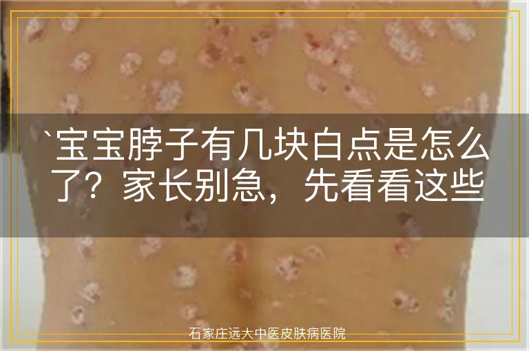 宝宝脖子有几块白点是怎么了？家长别急，先看看这些可能的原因
