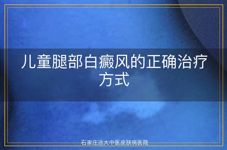 儿童腿部白癜风的正确治疗方式