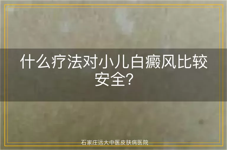 什么疗法对小儿白癜风比较安全？