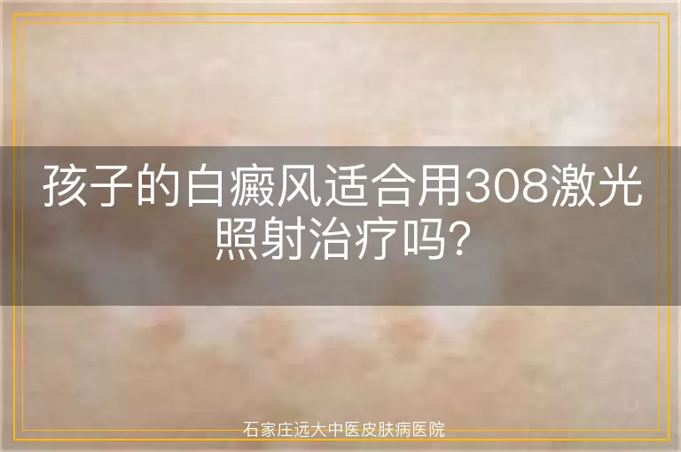 孩子的白癜风适合用308激光照射治疗吗？