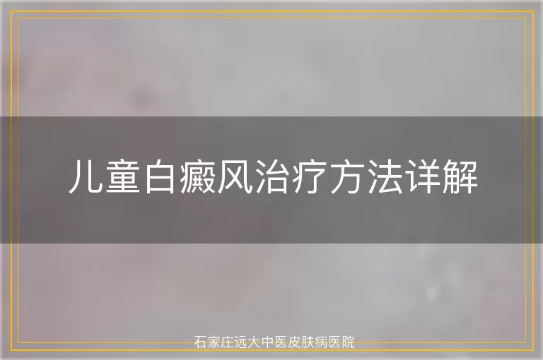 儿童白癜风治疗方法详解