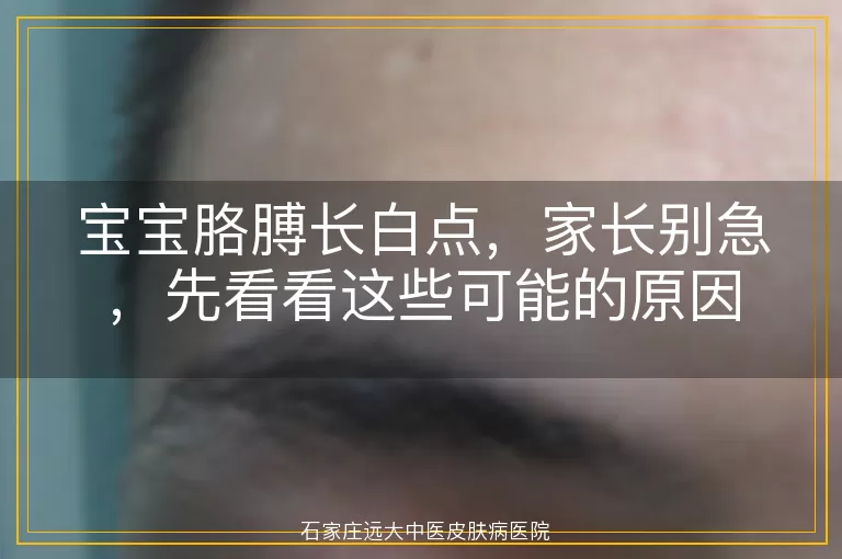 宝宝胳膊长白点，家长别急，先看看这些可能的原因