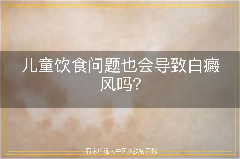 儿童饮食问题也会导致白癜风吗？