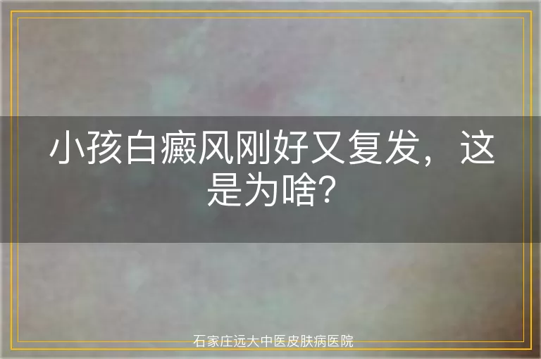 小孩白癜风刚好又复发，这是为啥？