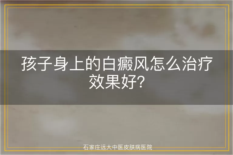 孩子身上的白癜风怎么治疗效果好？