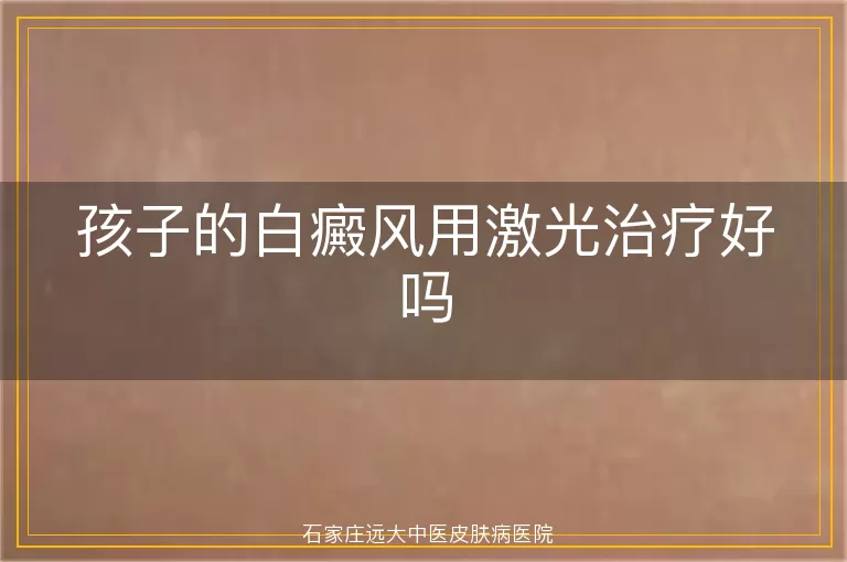 孩子的白癜风用激光治疗好吗