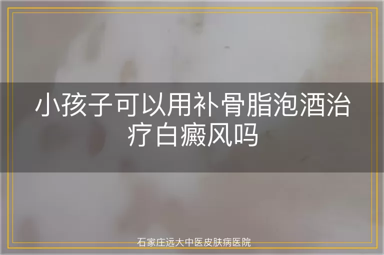 小孩子可以用补骨脂泡酒治疗白癜风吗