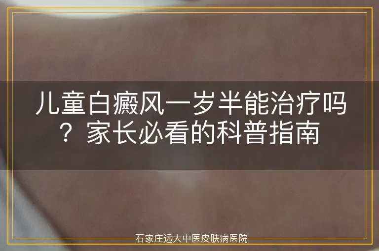 儿童白癜风一岁半能治疗吗？家长必看的科普指南