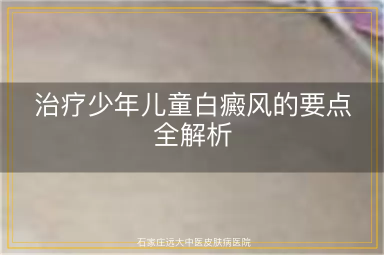 治疗少年儿童白癜风的要点全解析