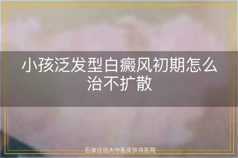 小孩泛发型白癜风初期怎么治不扩散