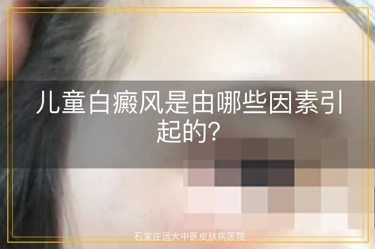 儿童白癜风是由哪些因素引起的？